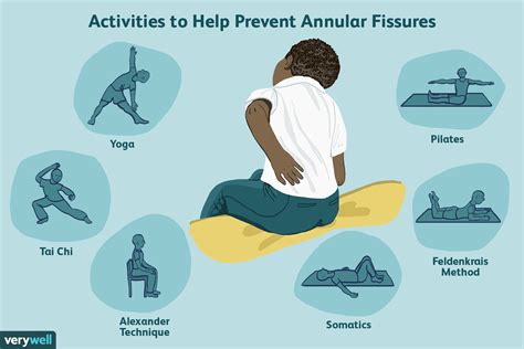 Annular Fissure Causes And Treatment