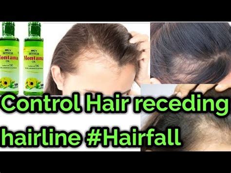 Homeopathic Hair Oil Hairfall Prob Provide Strength Promote Hair