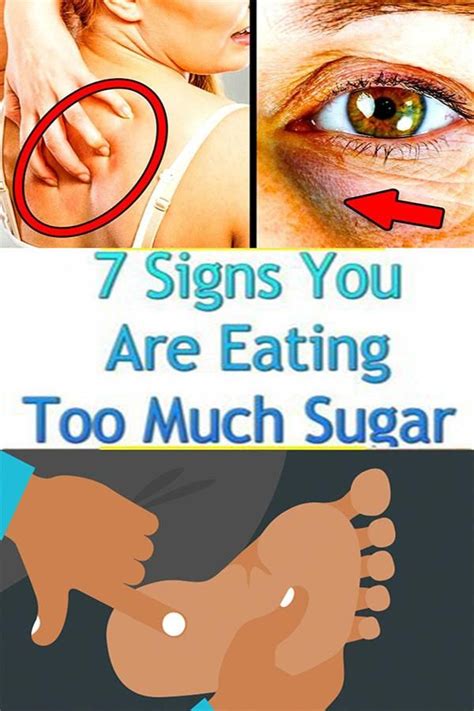 These Signs Indicates You Are Eating Too Much Sugar In Ate Too