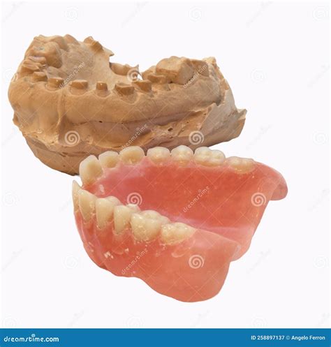 Plaster Impression Of Teeth. Dental Plaster Mold. Dental Mold Showing ...