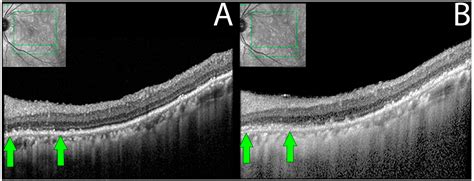 Diagnostics Free Full Text Structural And Functional Changes In Non