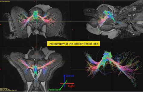 Squid brain could boost new technologies - Heart & Soul