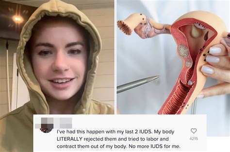 People Are Sharing Their Experiences Getting An Iud After This Woman Said She Felt Like She