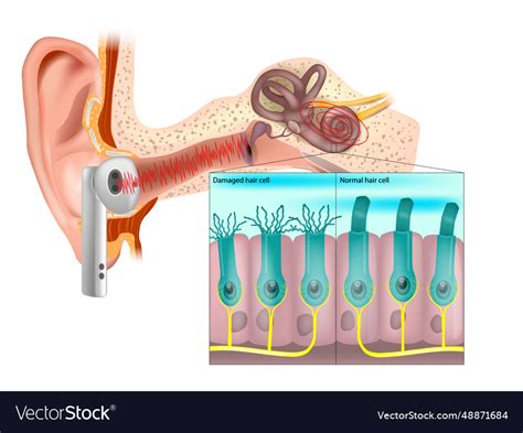 Healthy and damaged hair cells inside cochlea Vector Image