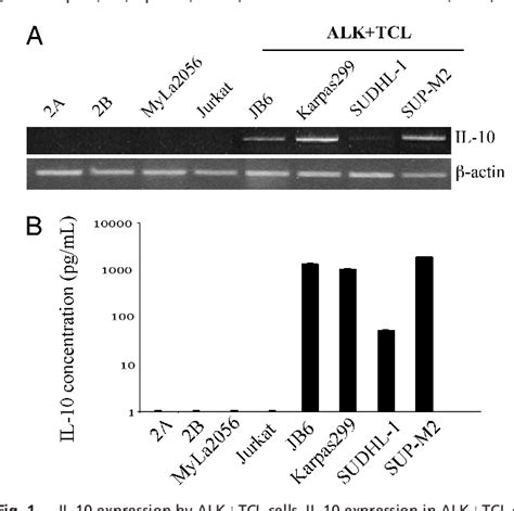 Figure 1 From Nucleophosmin Anaplastic Lymphoma Kinase NPM ALK