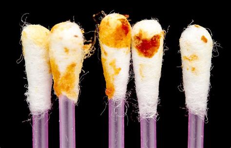 The Color And Texture Of Your Earwax Reveals Everything About Your