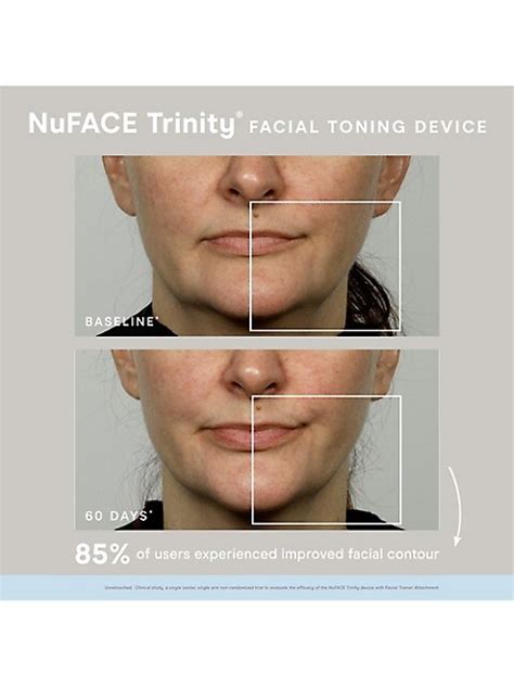 Nuface Trinity Facial Toning Device | TheBay