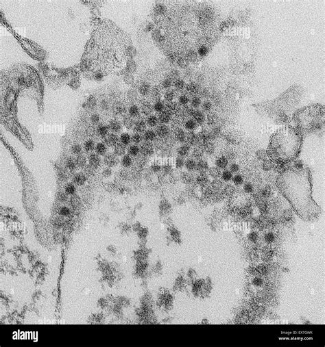 Virus Respiratorio Imágenes De Stock En Blanco Y Negro Alamy