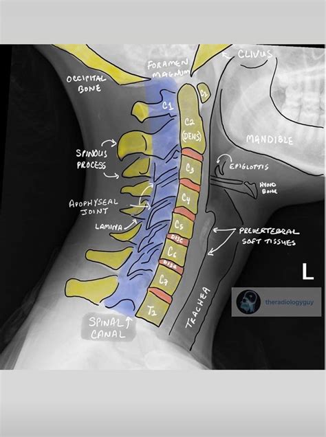 Radiographic anatomy of the skeleton cervical spine open mouth dens ...