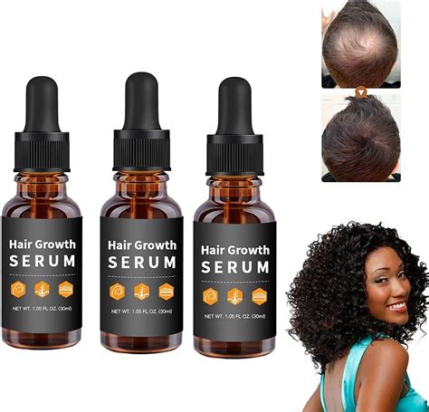 Allurium Hair Growth Serum Hair Growth Serum For Black Women Beauty Hair Growth Serum Anti