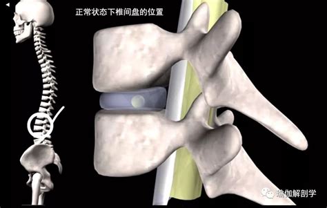 “老师，腰椎间盘突出的人不能练什么瑜伽动作？”前屈