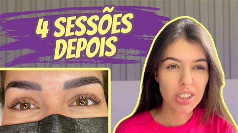 DESPIGMENTAÇÃO DE SOBRANCELHA MINHA EXPERIÊNCIA ANTES E DEPOIS YouTube