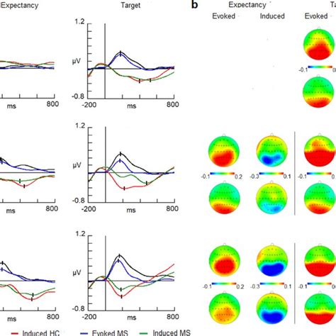 Schematics Of EEG Signal Processing Used To Obtain Evoked And Induced