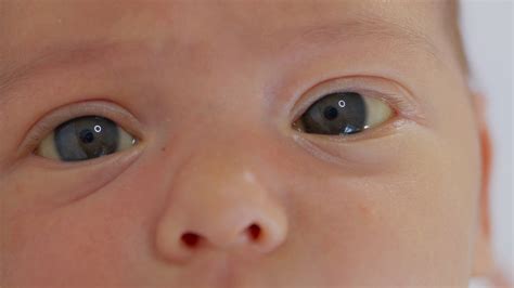 Close Up The Face Of A Newborn Baby In The Early Days Who Wakes Up And