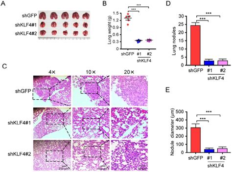 Knockdown Of KLF4 Suppresses Tumor Metastasis Of NSCLC In Vivo A And