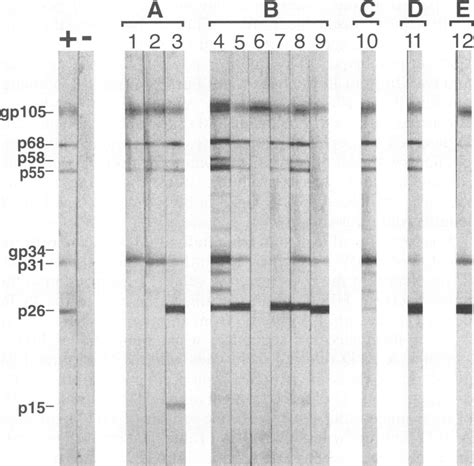 Western Blot Profiles Of Sera From Individ The Five Sequence Subtypes