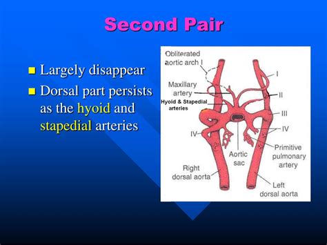 Ppt The Aortic Arches Powerpoint Presentation Free Download Id 2090347