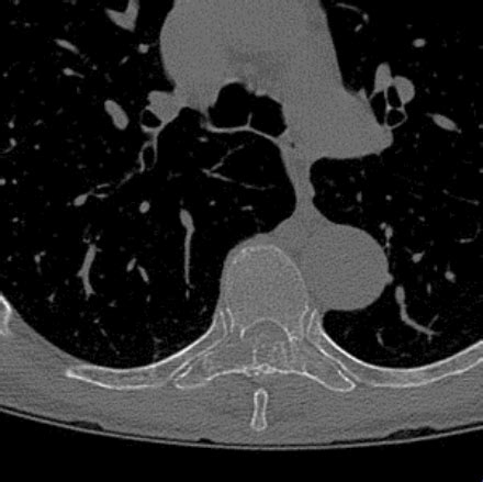 Question 126 MRI Online