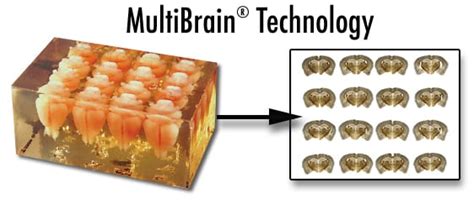 Multibrain Techv3 Neuroscience Associates