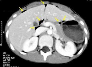 Gastrointestinal Tract Radiology Cases