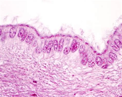 Ependymal Cells Histology