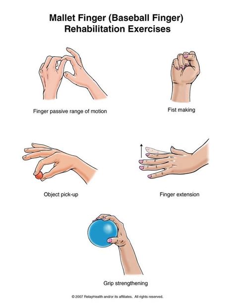 Hand Exercises For Patients With Arthritis at Larry Bridges blog