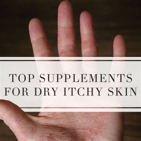 Best supplements for dry itchy skin - Top Eczema Treatments