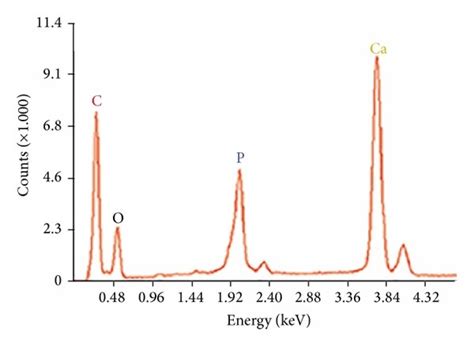 A Von Kossa Staining And Counterstaining With Methylene Blue Most