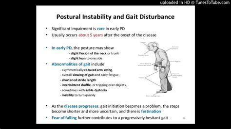 Postural Instability And Gait Disturbance Trip Specific Training