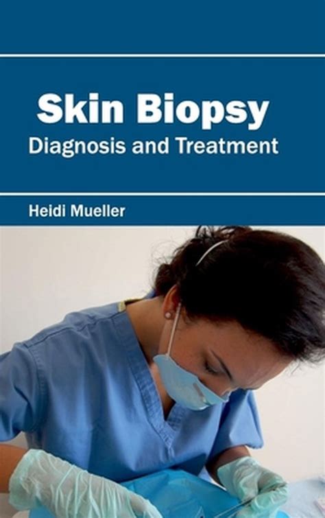 Skin Biopsy Diagnosis And Treatment 9781632423740 Boeken Bol