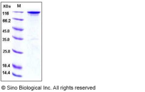 Sino Biological Human HER3 ErbB3 Protein Fc Tag Biotinylated 20ug