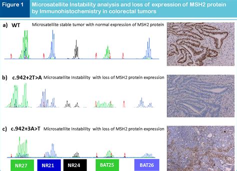 Figure 1 From Analytical Challenges In The Genetic Diagnosis Of Lynch