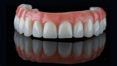 Pros And Cons Of Permanent Dentures Dmc