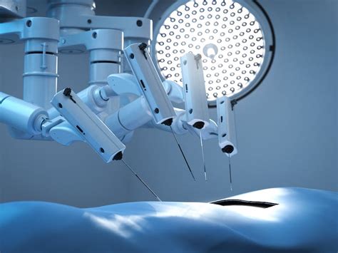 Approaching Robotic Assisted Surgery For Endometriosis Empowered