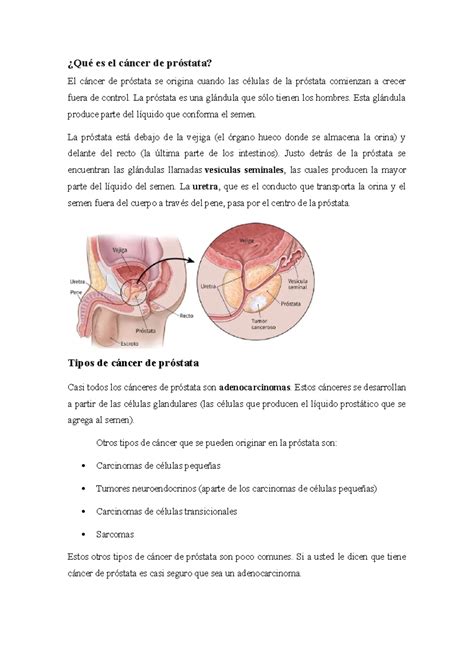 Cáncer DE Próstata RESUMEN DE ONCOLOGÍA Qué es el cáncer de