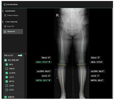 Diagnostics Free Full Text Difference In Correction Power Between