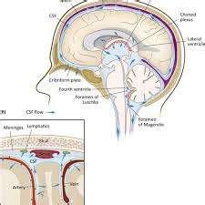 Cerebrospinal fluid (CSF) Analysis - Medical Lab Technician Online ...