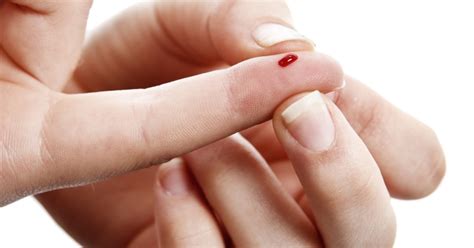 Will High Tech Skin Put An End To Needle Sticks For Diabetes