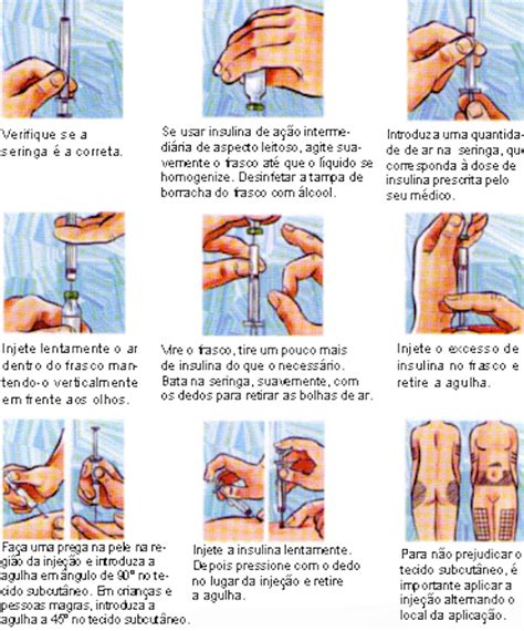 Como Aplicar Insulina Corretamente Ngulo Tipo De Agulha E Locais