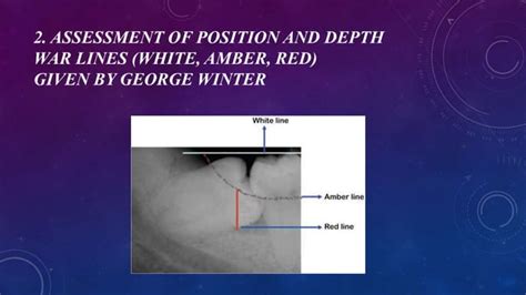 Radiographic Assessment Of Impacted Teeth Pptx