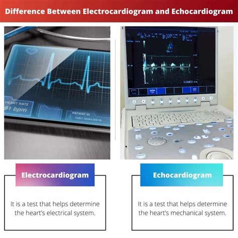 Electrocardiogram Vs Echocardiogram Difference And Comparison