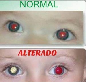 O Teste Positivo Será Observado Com Pesticida