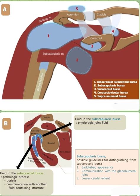 𝐃𝐫 𝐎𝐌𝐈𝐃 𝐁𝐀𝐍𝐃𝐀𝐑𝐂𝐇𝐈 𝐌 𝐃 on Twitter Image A Bursa aorund shoulder