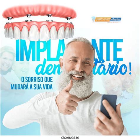 Implante Dent Rio O Seu Sorriso Que Mudar Sua Vida Implantes