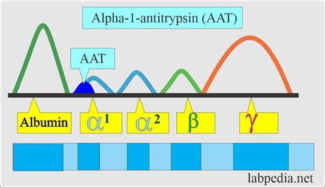 alpha 1 antitrypsin Deficiency α1 antitrypsin or AAT Deficiency