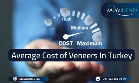 The Average Cost Of Veneers In Turkey In 2024