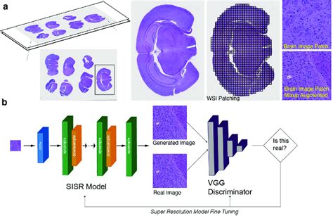 Data Preprocessing And Model Architecture Overview A Hr Image Patches