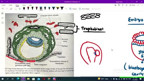 Second Week Of Development Bilaminar Germ Disc General Embryology