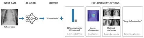 Explainable AI XAI Implement Explainability In Your Work Synthetic