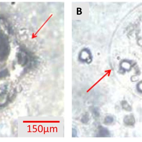 Light Microscopic Morphology Of Microbead Encapsulation Of